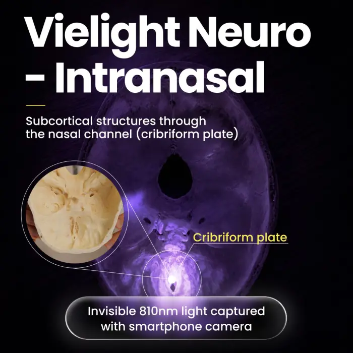 Vielight | Neuro Gamma 4: Transcranial Photobiomodulation Helmet