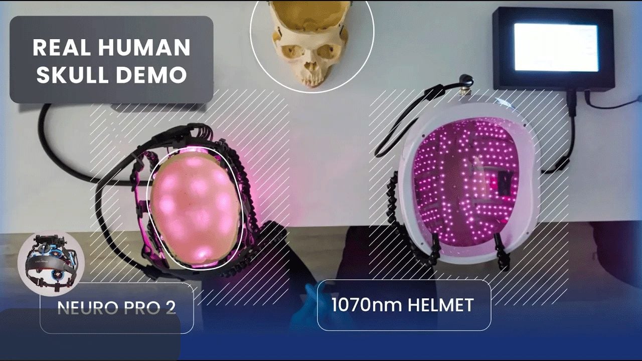 Neuro vs. 1070nm Helmet Face-Off. Who Wins?