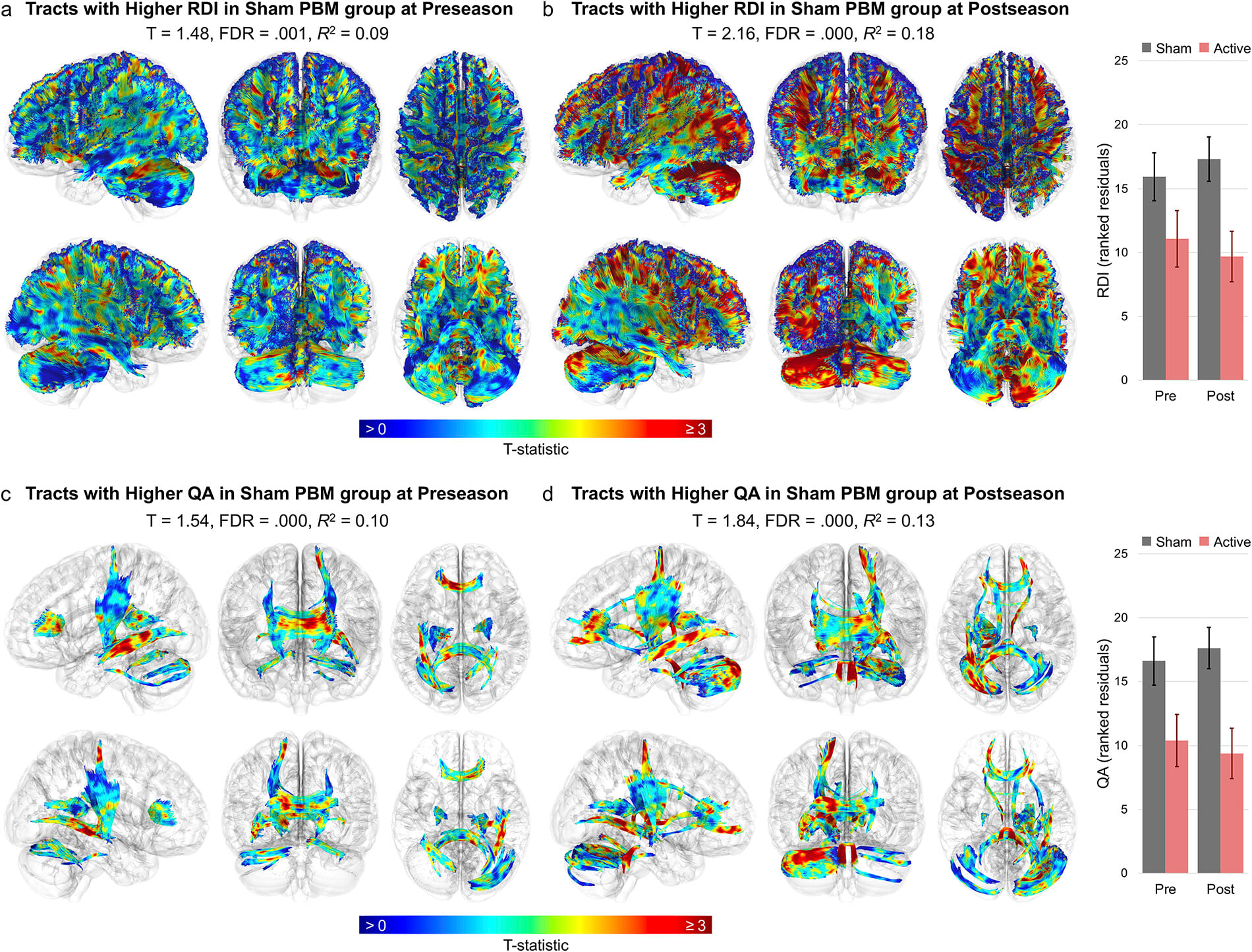 Diffusion MRI rendering highlighting deep midline brain structures including the midbrain, brainstem, corpus callosum, thalamus and basal ganglia.