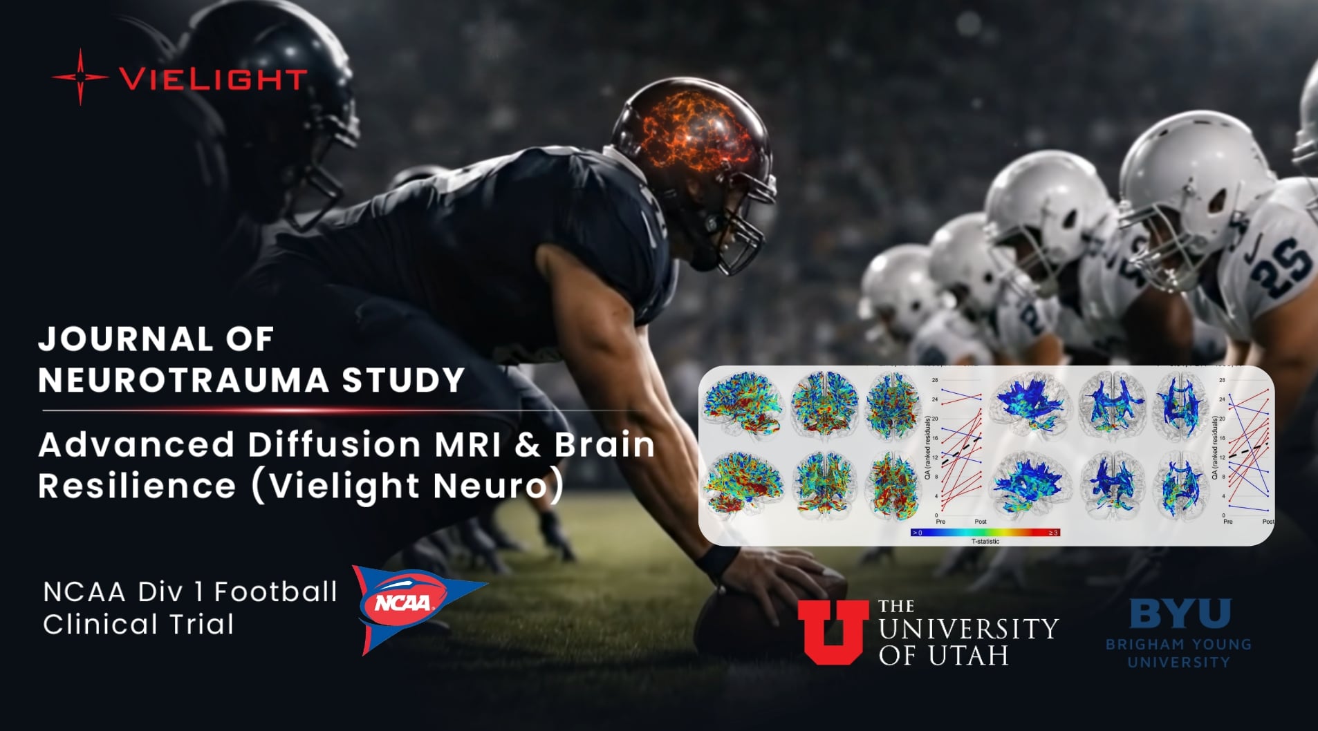 The $4.6M Vielight x DoD TBI Trial – And the MRI Evidence Behind It