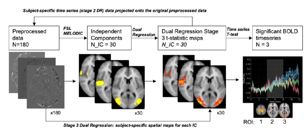 Baycrest intranasal photobiomodulation study design, BOLD fMRI imaging