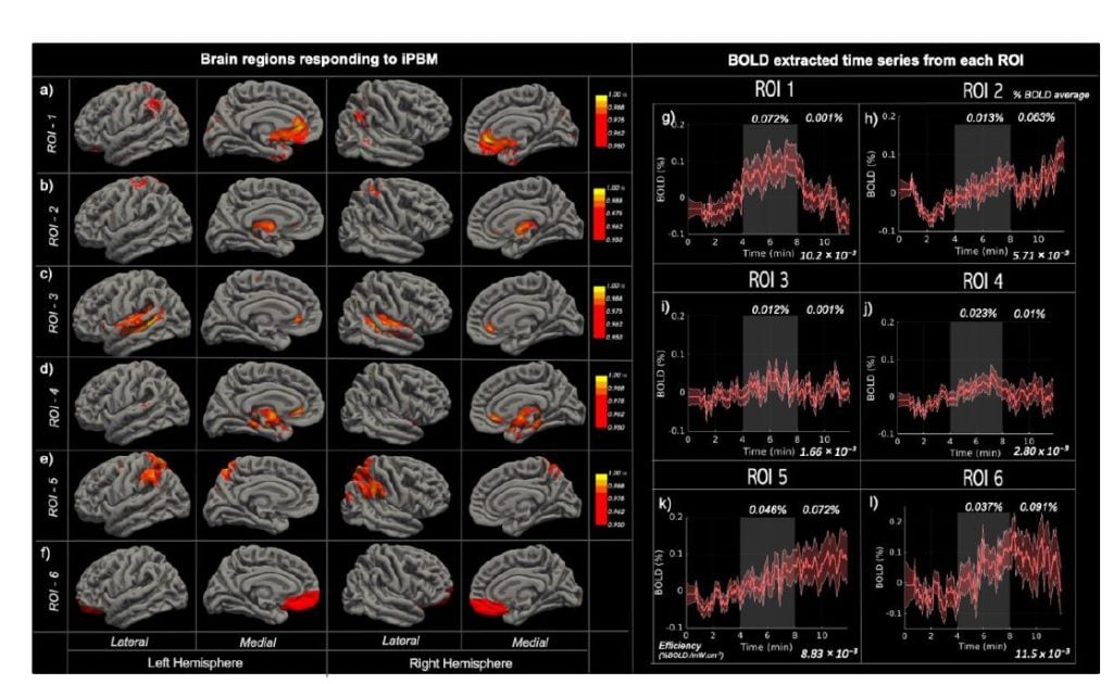 BOLD fMRI response across brain regions following intranasal photobiomodulation