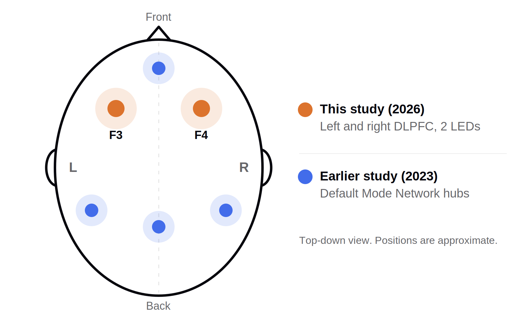 Top-down diagram of a head showing near-infrared LEDs over the left and right dorsolateral prefrontal cortex (F3 and F4) in this study, and Default Mode Network hubs targeted in an earlier study.
